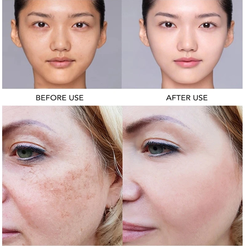 AILKE Whitening Face Care Set, Moisturizing, Brightening, With Collagen Vitamin C, Even Skin Tone, Suitable for Men and Women - Image 4