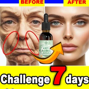 wrinkles disappeared