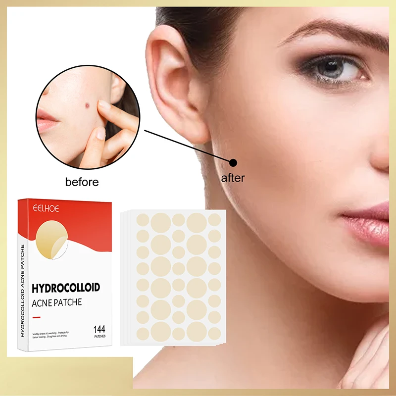 144pcs/set Face Skin Care Acne Pimple Patch 2 Sizes Invisible Professional Healing Absorbing Spot Sticker Covering for Men Women - Image 3