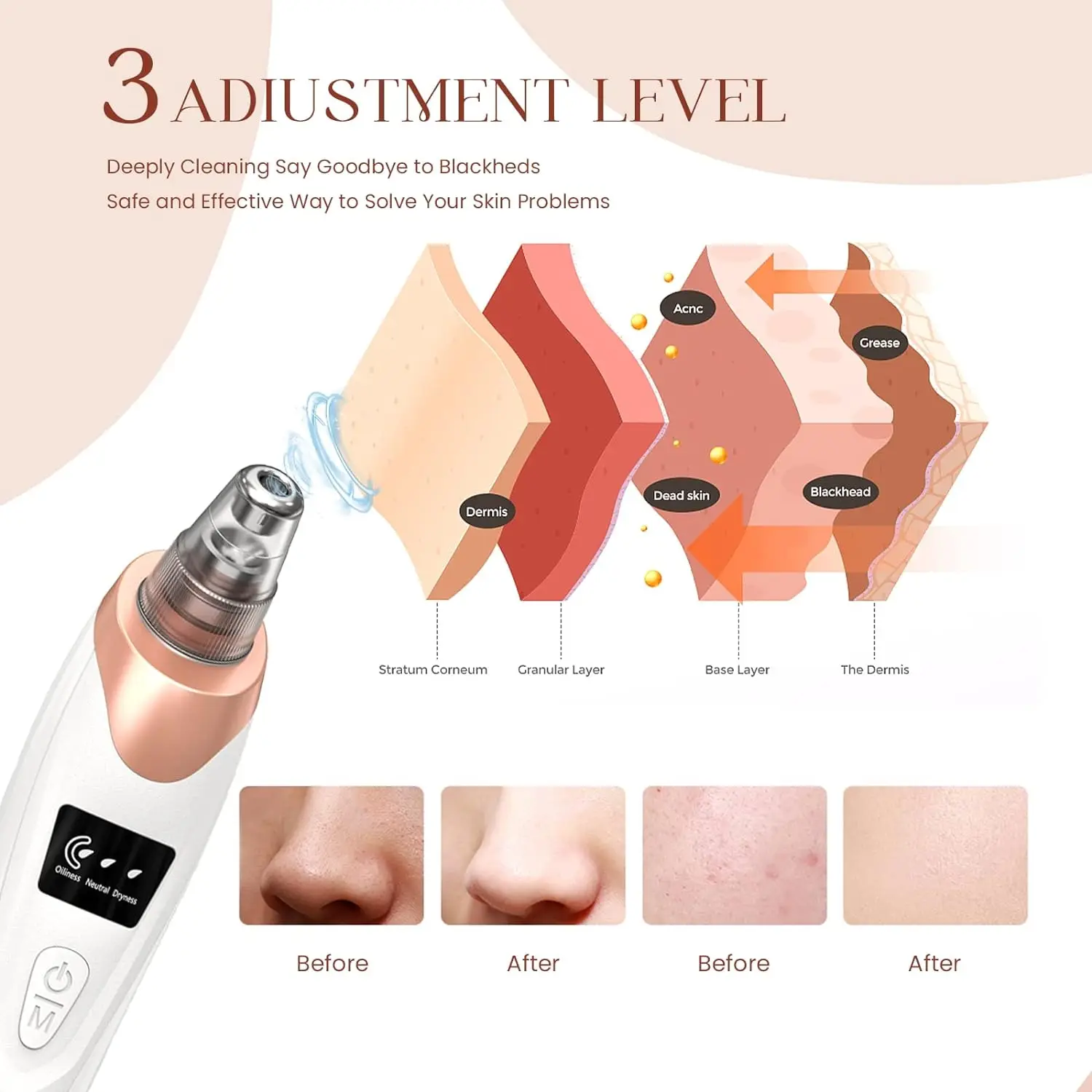 Newest Technology Blackhead Remover Vacuum Pore Cleaner for Face&Nose Blackhead Removal Kit Electric Acne Facial Extractor Tool - Image 3