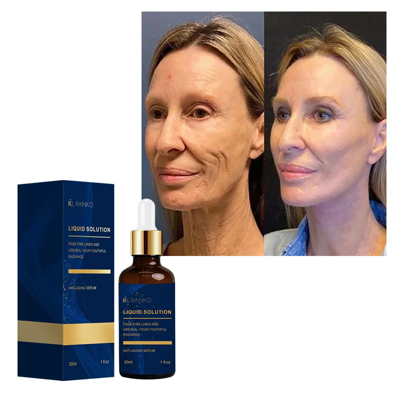 Niacinamide Wrinkle Remover Serum Firming Lifting Face Care Anti-Aging Fade Fine Lines Smooth Skin Beauty Facial Essence Liquid - Image 4