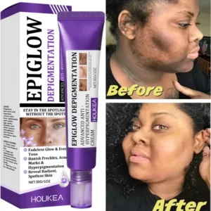 Whitening Freckle Cream Melasma Dark Spots Pigmentation Removal Product Fade Stain Melanin Fast Repair Brighten Korean Skin Care