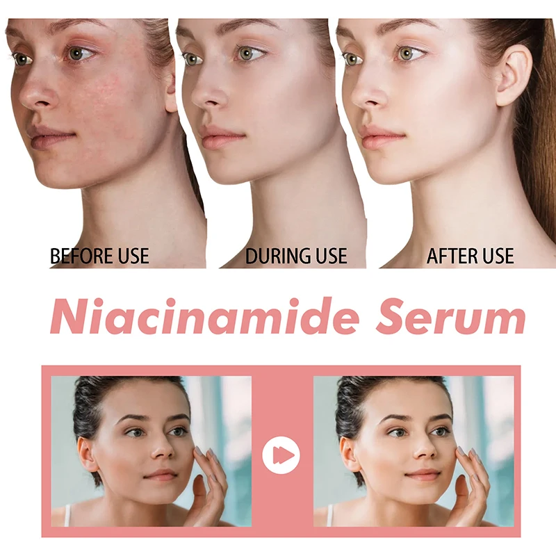 Peach 70% Niacinamide Serum 30ml Moisturizing Prevent Dryness Facial Essential Oil Increasing Elasticity Smooth Soften Skin Care - Image 2