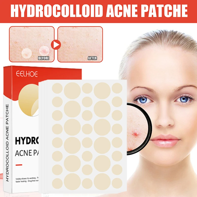 144pcs/set Face Skin Care Acne Pimple Patch 2 Sizes Invisible Professional Healing Absorbing Spot Sticker Covering for Men Women