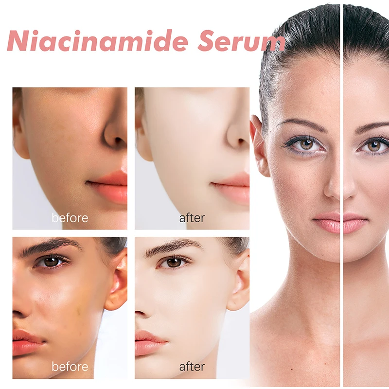 Peach 70% Niacinamide Serum 30ml Moisturizing Prevent Dryness Facial Essential Oil Increasing Elasticity Smooth Soften Skin Care - Image 3