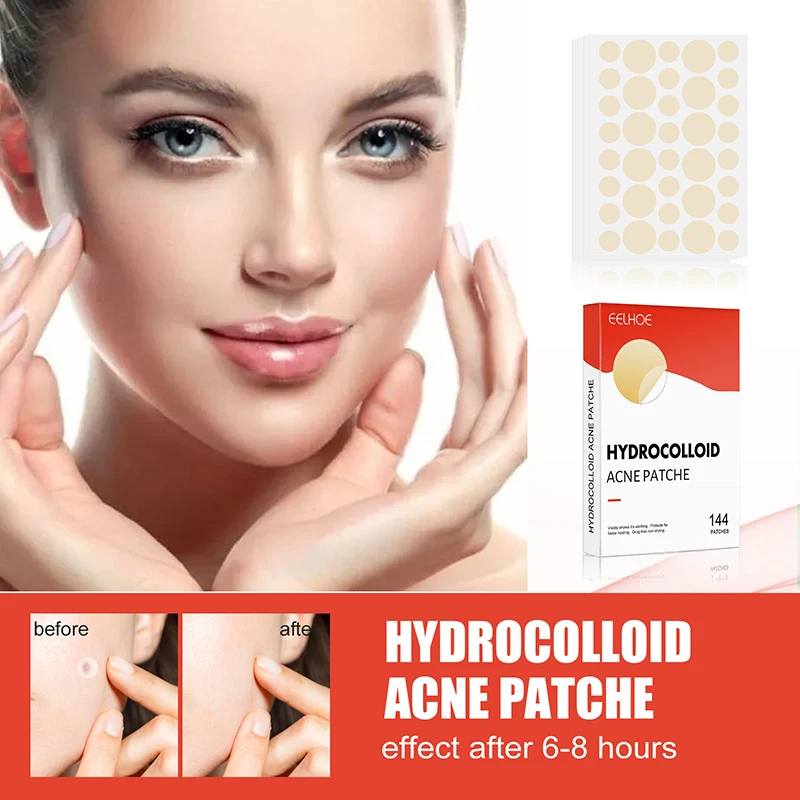 144pcs/set Face Skin Care Acne Pimple Patch 2 Sizes Invisible Professional Healing Absorbing Spot Sticker Covering for Men Women - Image 4