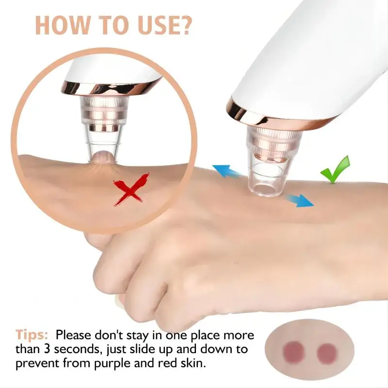 Newest Technology Blackhead Remover Vacuum Pore Cleaner for Face&Nose Blackhead Removal Kit Electric Acne Facial Extractor Tool - Image 6