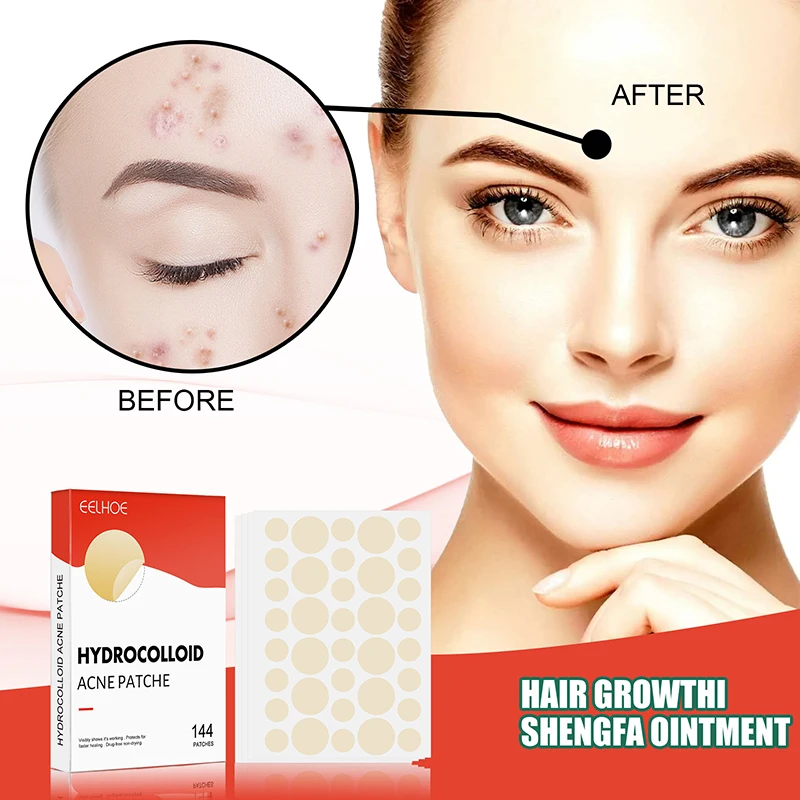 144pcs/set Face Skin Care Acne Pimple Patch 2 Sizes Invisible Professional Healing Absorbing Spot Sticker Covering for Men Women - Image 2