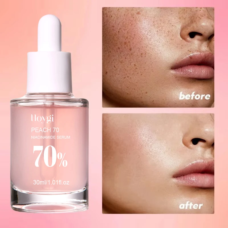 Peach 70% Niacinamide Serum 30ml Moisturizing Prevent Dryness Facial Essential Oil Increasing Elasticity Smooth Soften Skin Care - Image 5