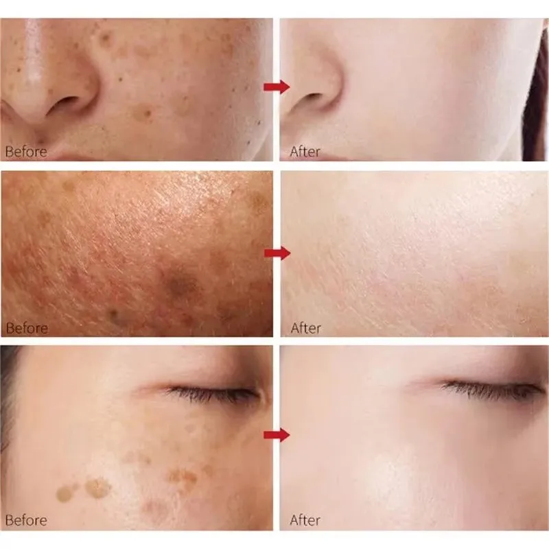 Peach 70% Niacinamide Serum 30ml Moisturizing Prevent Dryness Facial Essential Oil Increasing Elasticity Smooth Soften Skin Care - Image 4