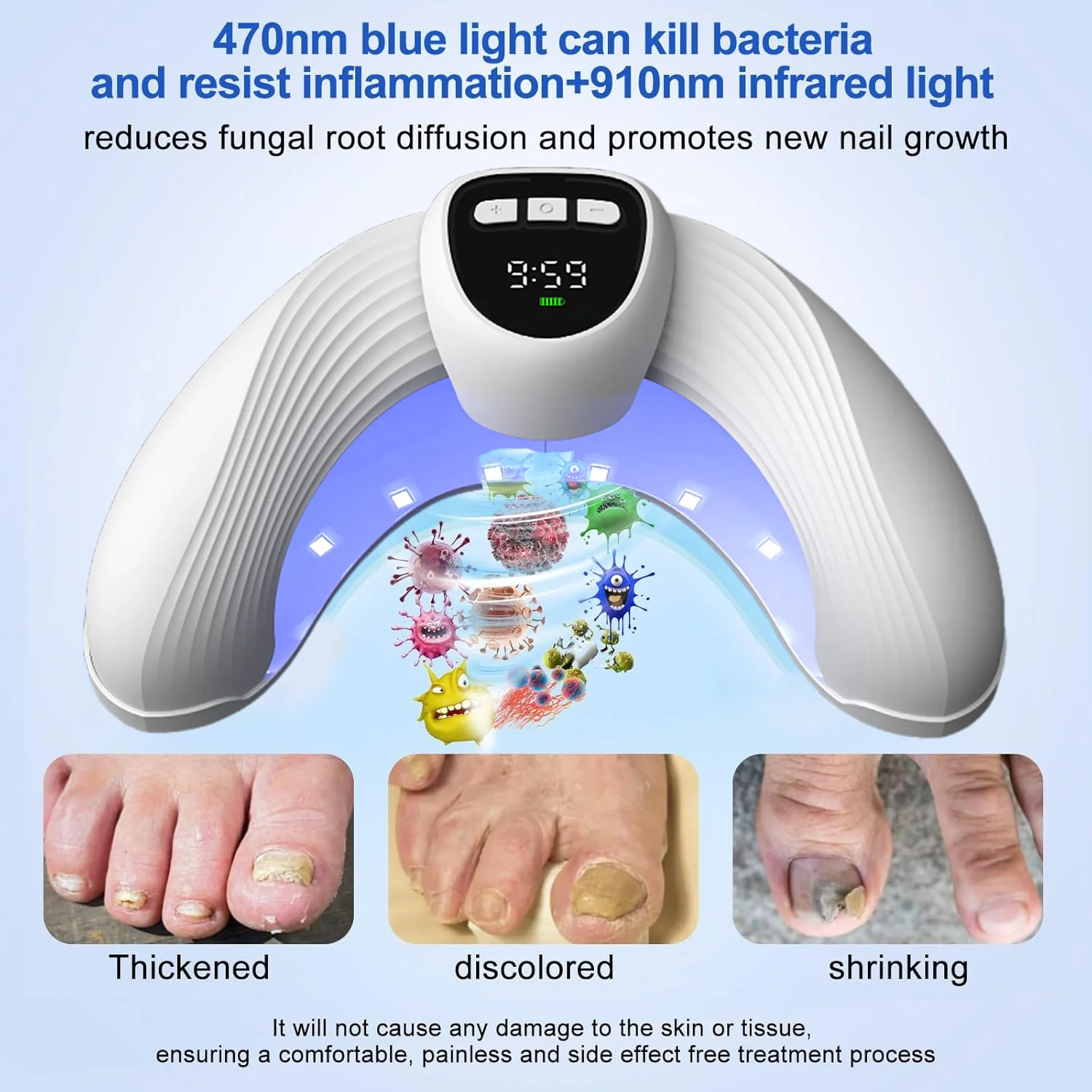 Nail phototherapy lamp rapid repair of onychomycosis foot care to eliminate nail fungus nail lamp LED display - Image 4