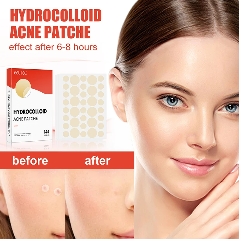 144pcs/set Face Skin Care Acne Pimple Patch 2 Sizes Invisible Professional Healing Absorbing Spot Sticker Covering for Men Women - Image 5